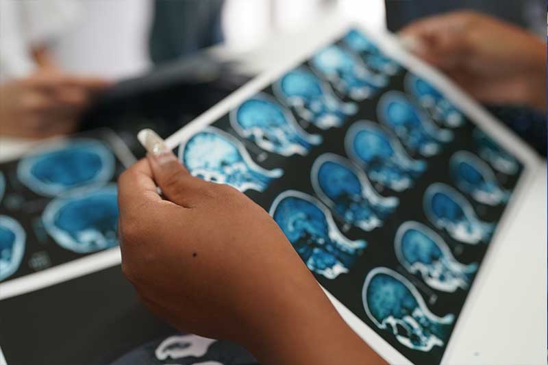 Catastrophic injury brain scan — Edmonds, Washington